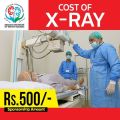 Cost of X-ray Facility for a Kidney Patients. 
