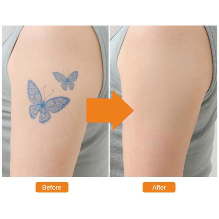 Goglor%20Tattoo%20Scar%20Concealer%20Cover%20Tattoo%20Tape%20Color%20Waterproof%20Seamless%20Removal%20of%20Any%20Spot%20-%20Breathable%20Skin-friendly,%20Fast%20Surface%20Ultra-thin%20Imitation%20Skin%20-%20Image%207