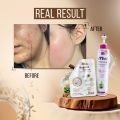 Malika Cosmetics Korean Cream - 250 & 50 ml - Advanced Skin Enhancer - Hand Cream For Girls - Face & Body Moisturizer - Moisturizer - Non Greasy Formula - Night Cream -  Skin Brightening - Cream - Professional Beauty Care - Kass Cosmetics. 
