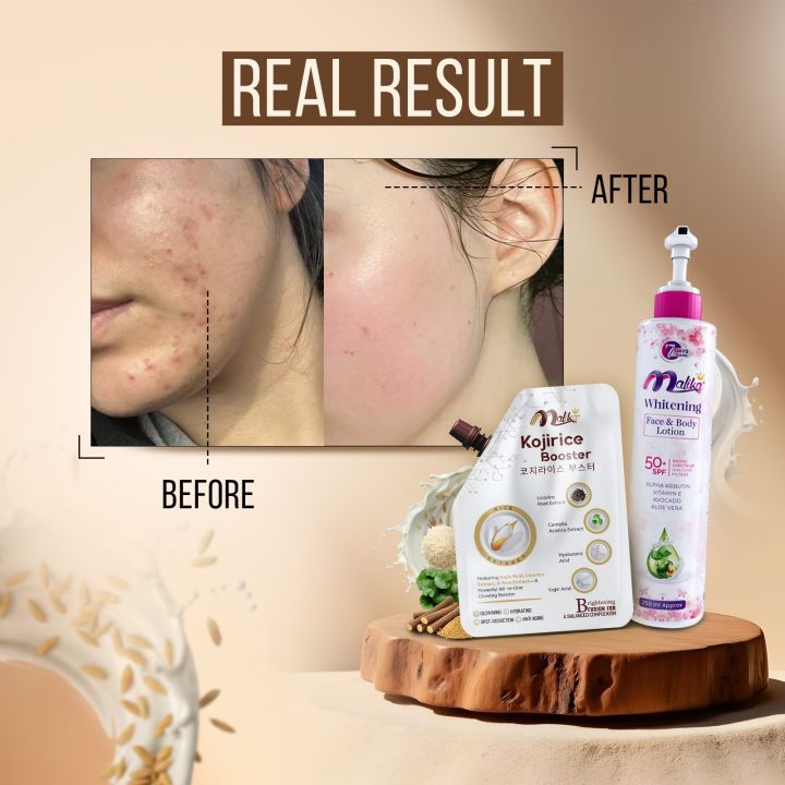 Malika%20Cosmetics%20Korean%20Cream%20-%20250%20&%2050%20ml%20-%20Advanced%20Skin%20Enhancer%20-%20Hand%20Cream%20For%20Girls%20-%20Face%20&%20Body%20Moisturizer%20-%20Moisturizer%20-%20Non%20Greasy%20Formula%20-%20Night%20Cream%20-%20%20Skin%20Brightening%20-%20Cream%20-%20Professional%20Beauty%20Care%20-%20Kass%20Cosmetics%20-%20Image%202