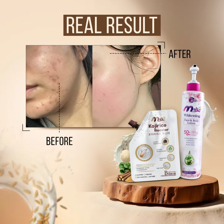 Malika%20Cosmetics%20Korean%20Cream%20-%20250%20&%2050%20ml%20-%20Advanced%20Skin%20Enhancer%20-%20Hand%20Cream%20For%20Girls%20-%20Face%20&%20Body%20Moisturizer%20-%20Moisturizer%20-%20Non%20Greasy%20Formula%20-%20Night%20Cream%20-%20%20Skin%20Brightening%20-%20Cream%20-%20Professional%20Beauty%20Care%20-%20Kass%20Cosmetics%20-%20Image%202