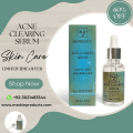 Serum | Serum for glowing skin | Acne Remove Serum | ACNE CLEARING FACE SERUM | 30ML | MZ SKINCARE. 