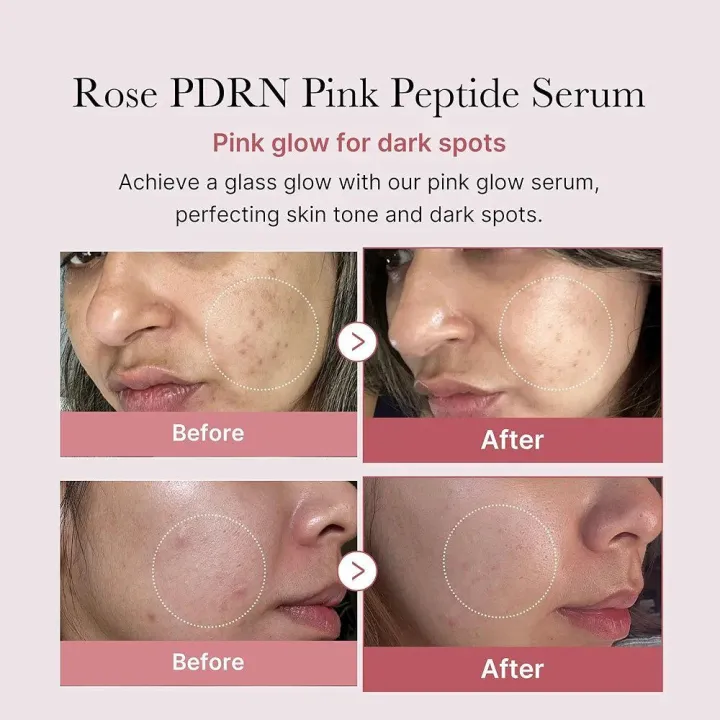 Medicube%20PDRN%20Pink%20Peptide%20Serum%2030ml%20%E2%80%93%20Pink%20Peptide%20Repair%20Formula%20%E2%80%A2%20Anti-Aging%20%E2%80%A2%20Firming%20%E2%80%A2%20Hydration%20Boost%20%E2%80%A2%20Radiance%20&%20Skin%20Renewal%20Essence%20-%20Image%205