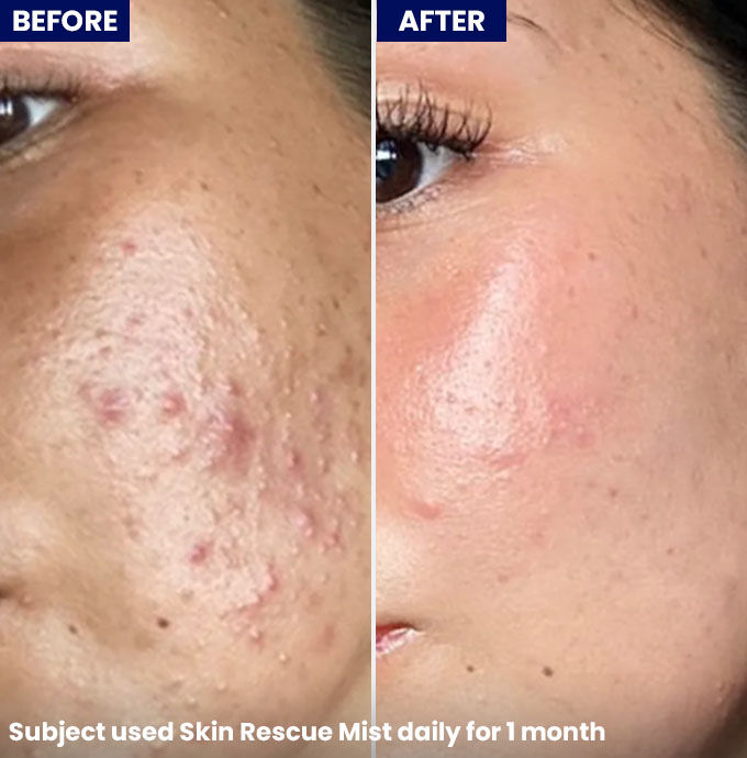 Jenpharm%20Skin%20Rescue%20Mist%20-%20Image%206