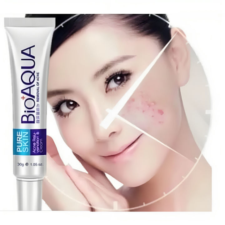 BIOAQUA%20Pure%20Skin%20Acne%20Removal%20Anti%20Wrinkle%20Treatment%20Cream%2030Gm%20-%20Image%202