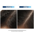 Tressfix Hairfall & Anti-Dandruff Shampoo. 