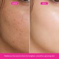Olim Naturals-  Facial Glow Serum with Vitamin C & Peptides for Anti-Aging, Fine Lines, Wrinkles, and Brightening- 30ml. 