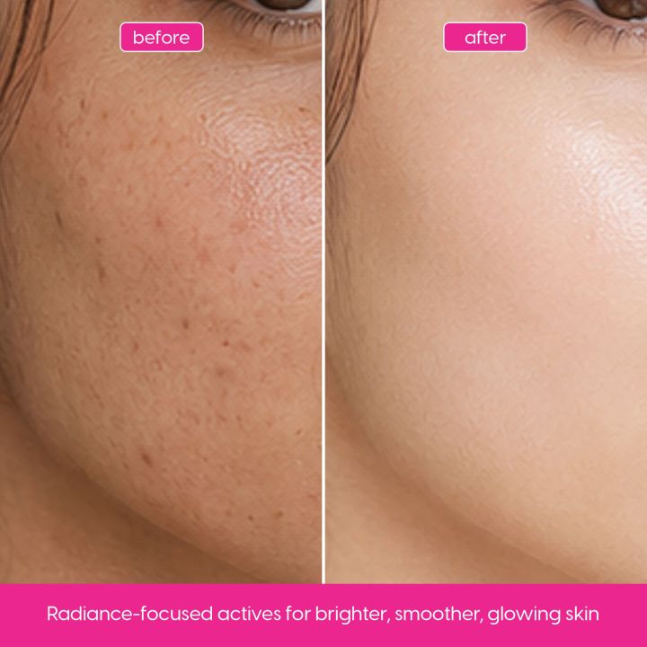 Olim%20Naturals-%20%20Facial%20Glow%20Serum%20with%20Vitamin%20C%20&%20Peptides%20for%20Anti-Aging,%20Fine%20Lines,%20Wrinkles,%20and%20Brightening-%2030ml%20-%20Image%202
