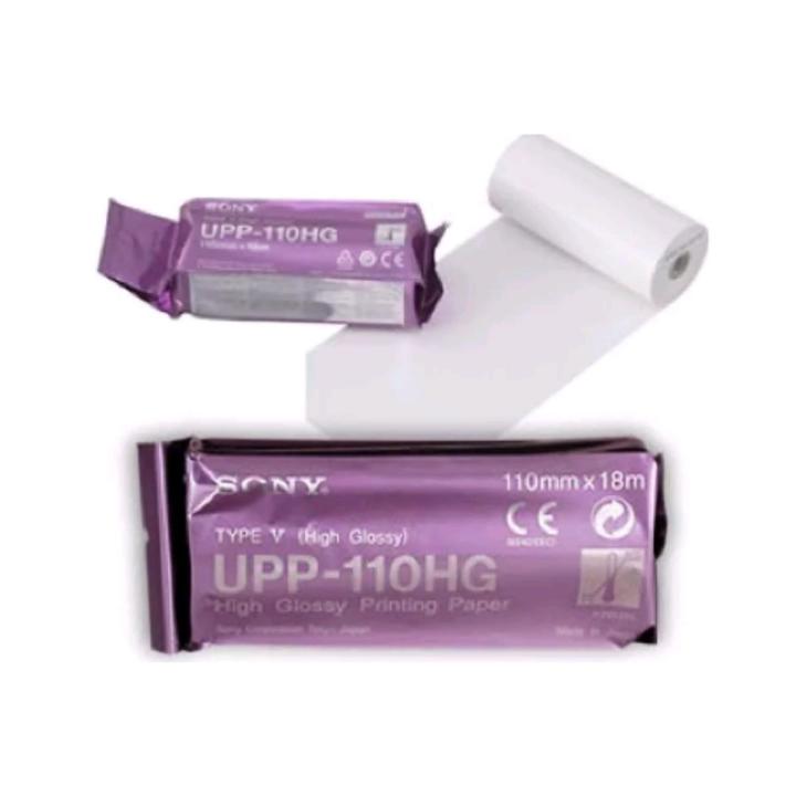 Ultrasound Printing Paper Roll - High Glossy Ultrasound Paper Price – High Quality 110HG High Glossy Thermal Video Printer Paper / Ultrasound Printer Paper Roll (110mm x 18M) - Sony Compatible UPP-110HG Price in Pakistan