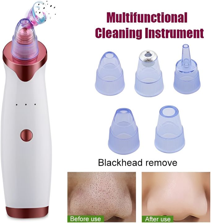 Blackhead Remover Pore Vacuum Electric Pore Cleanser USB Rechargeable Face Cleaner Skin Glow Electric Cleanser