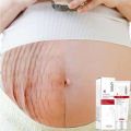 EFERO Repair Cream Removal Scar Stretch Marks Postpartum Maternity Skin Solution. 