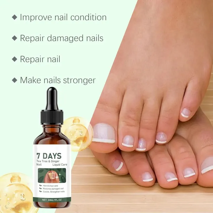 7%20Days%20Ginger%20Nail%20Growth%20Serum%20%E2%80%93%20Nail%20Strengthening%20and%20Nourishing%20Serum%20for%20Healthy,%20Shiny%20and%20Strong%20Nails%20-%20Image%204