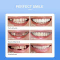 Snap on Smile Teeth - Hismile Smile Teeth Cover, Teether, Teeth Whitening Strips, Teeth Whitening Product, Braces for Teeth Steel, and Teeth Cover Cap Plastic. 