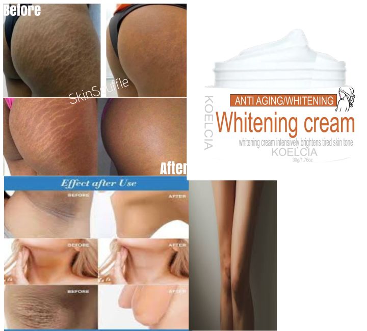 KOELCIA%20Whitening%20Cream%20for%20Sensitive%20Areas,%20Anti-Aging%20&%20Skin%20Tone%20Evenness,%20-%20Image%204
