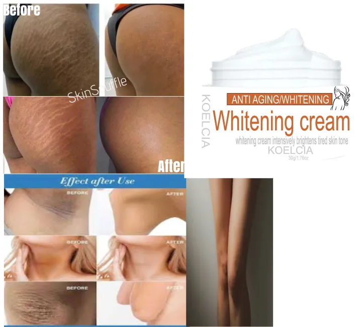 WHITENING%20CREAM%20skin%20lightening%20FOR%20intimate%20area%20private%20parts%20vigin..a%20under%20arm%20-%20Image%204