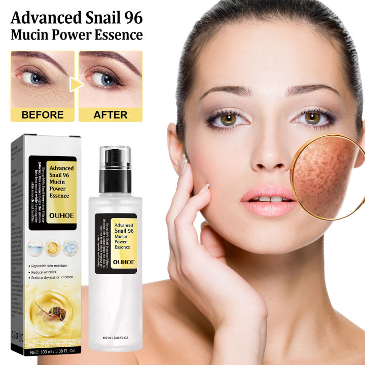 Snail Mucin 96% Power Repairing Essence Lift Firm Anti-aging Fade Fine Lines Acne Treatment Facial Sensitive Whitening Brighten