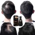 Pei Mei Hair Growth Biotin Cold Pressed DHT Blocker Anti Hair Loss Shampoo 250ml. 