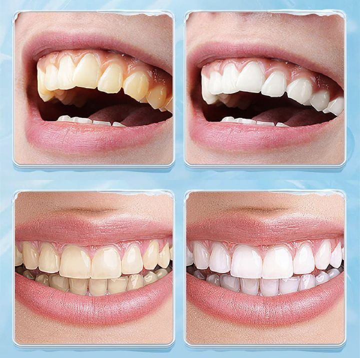 1/2%20pc%20Manual%20Teeth%20Stain%20Eraser%20Manual%20Dental%20Teeth%20Stain%20Eraser%20and%20Plaque%20Remover%20-%20Handheld%20Teeth%20Polishing%20Flosser%20for%20Oral%20Hygiene,%20No%20Electricity%20or%20Battery%20Needed%20Teeth%20Stain%20Remover%20Sticks%20with%20Carbonized%20Silicone%20Hard%20Brush%20Heads%20Deep%20Clean%20-%20Image%204