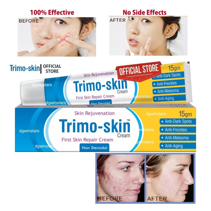 Trimo Skin Cream Skin Whitening for Face, Scar Removal, Acne, Hand, Foot, and Pigmentation Skin Care Products Freckles Removing Cream For All Skin Types | Skin Care Products
