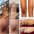 Quickly Private Parts Whitening Cream Bikini Area Brightening Cream Body Underarm Bleaching Emulsion Women Intimate Area Care. 
