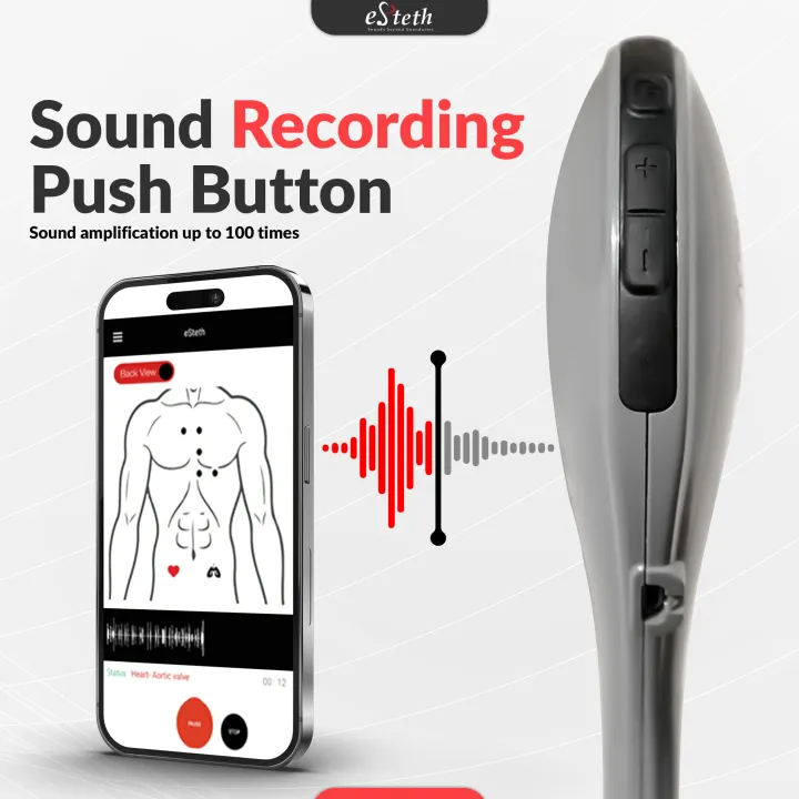 eSteth%20Lite%20Digital%20Stethoscope%20for%20Live%20and%20Store-and-Forward%20Telemedicine%20-%20Image%207