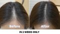 Hair Growth Serum Pack of 3 Natural Hair Oil - Hair Growth Oil - Hair fall Oil - Onion Oil, Garlic Oil, Ginger Oil, Rosemary Oil, Olive Oil, Castor Oil, Almond Oil & More Hair Regrowth Serum For Hair Loss Treatment Growth. 