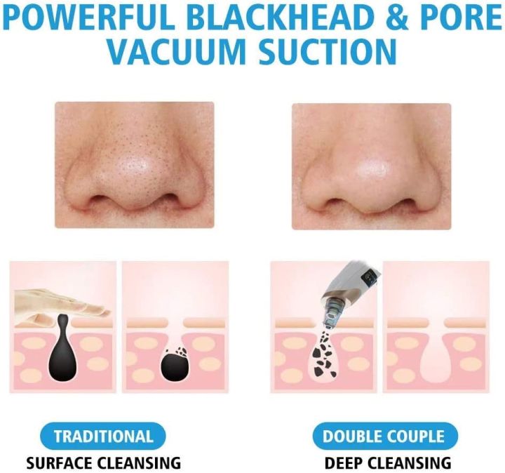 4%20in%201%20Multi-functional%20Black%20Head%20Removal%20Machine%20Derma%20Suction%20Machine%20Blackhead%20Remover%20-%20Image%206
