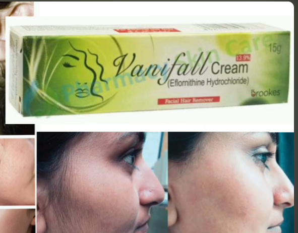 VANIFALL CREAM (13.9%) 15g baby