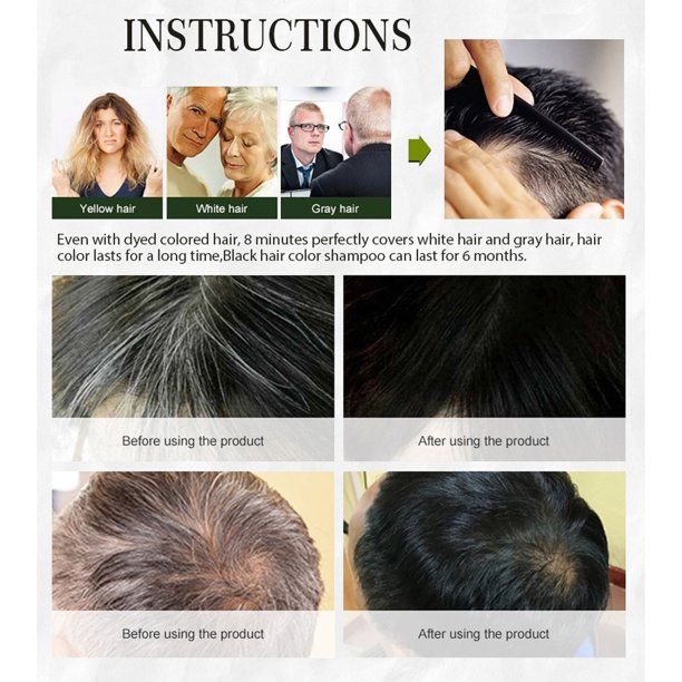 Chirs%20Dark%20Brown%20Professional%20Hair%20Color%20Gel%20For%20Men%20&%20Women%20With%20Argan%20Extract-%20500ml%20X%202%201000ml%20-%20Image%206