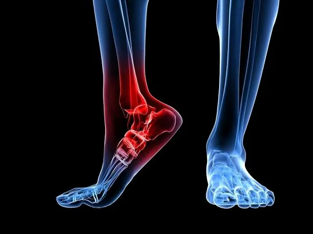 Unisex%20Solid%20EVA%20material%20MCR%20PU%20Gel%20And%20Anti-bacterial%20Fabric%20Insole%20Foot%20Care%20Provide%20Better%20Cushioning%20for%20Plantar%20Fasciitis%20Heel%20Spur%20Sport%20Shoe%20Pad%20Insoles%20Arch%20Orthopedic%20Insole%20Breathable%20Foam%20Shoe%20Pads%20Free%20to%20Trim-able%20Invisible%20Increased%20Heel%20Li%20-%20Image%205