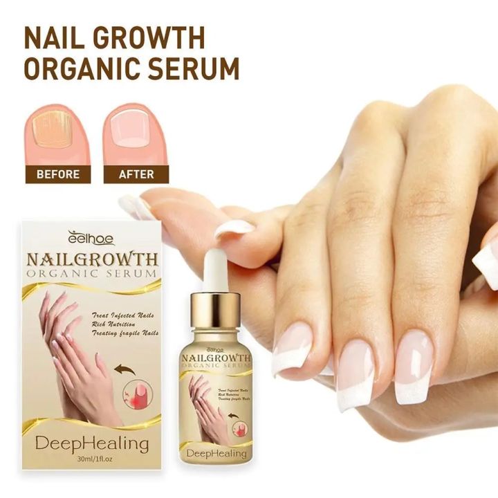 Nailgrowth Deephealing Serum Nail Growth And Strengthening Fix Renew Damage Nail Goods For Manicure All