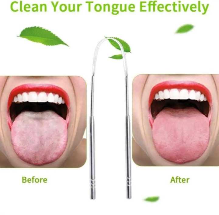 Fight%20Bad%20Breath%20Medical%20Grade%20Stainless%20Steel%20Tongue%20Scraper%20-%20Image%202