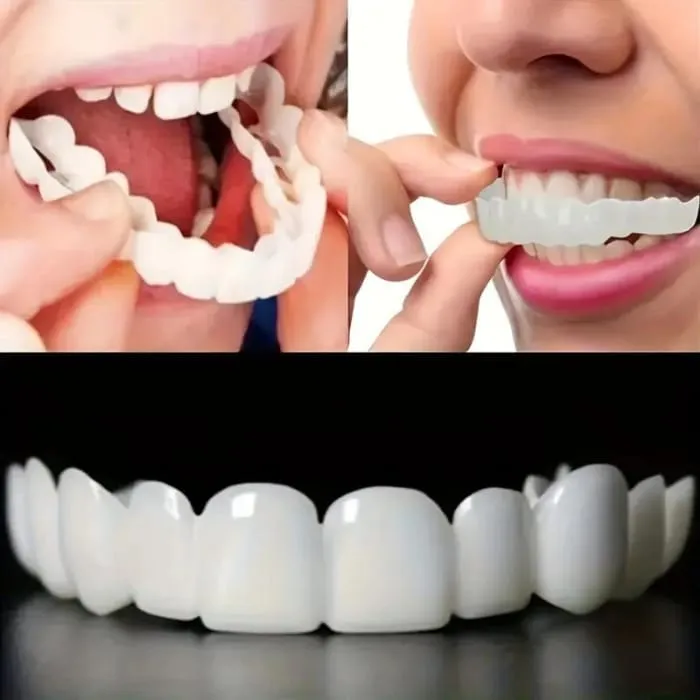Perfect%20Fit%20Snap-On%20Smile%20Veneers%20%E2%80%93%20Upper%20&%20Lower%20Natural%20Look%20Teeth%20Covers%20&%20Braces%20-%20Image%206