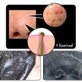 Lichen Blackhead Remover Mask, Peel Off Face Mask, Charcoal Face Mask for Black Head Remover, Skin Deep Cleansing for Face Nose Blackhead Pores Acne, Women & Men Face Skin Care - 100 ml. 