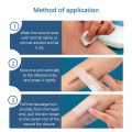 【HOT】 Wound Skin Closure Strips Postpartum Wound Repair Cosmetic Surgery Steri Strip Adhesive Medical Suture Free Surgical Tape. 