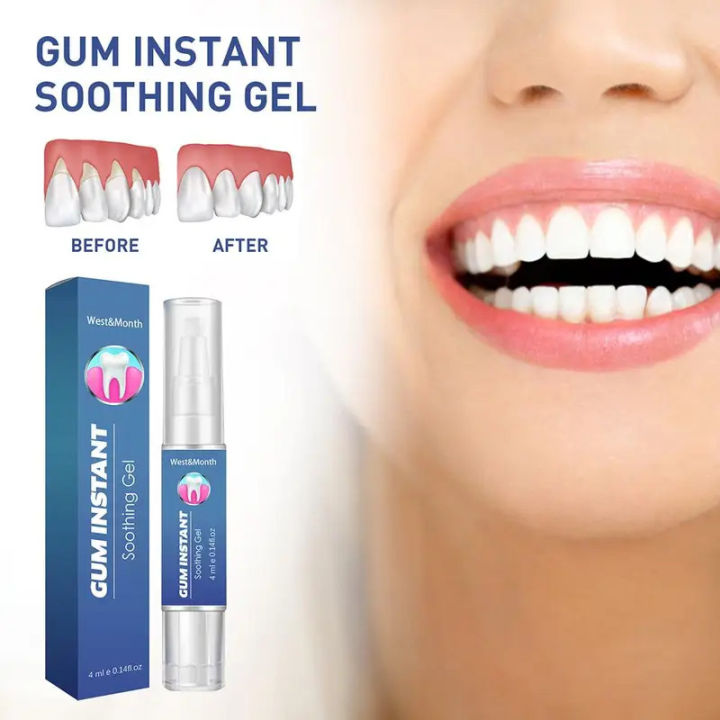 Mouthpaste 4ml Soothing Antiseptic Gel Treatment Inflamed Gums Mouth Ulcers Mouth ...