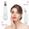 GIVA Blackhead Remover Electric Detector Vacuum Suction Blackhead Acne Extractor Pores Deeply Cleaning Tool Multifunctional Skin Care Beauty Device. 