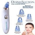 Derma Suction 4 in 1 Pore Cleaning Device With Vacuum Action Face Pore Cleaner Facial Beauty Equipment Battery Operated. 