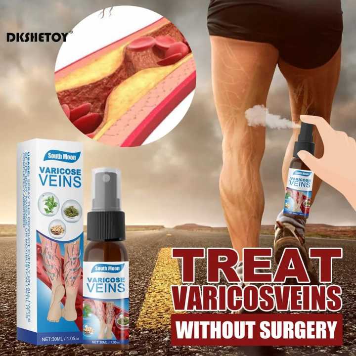 30ml Vein Healing Varicose Veins Treatment Spray Essential Oil Relief Phlebitis Angiitis Remedy Pain Spray Relief Leg Pain Spine Pain
