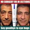 Eye Cream Instant Anti Aging Remove Dark Circles Wrinkle Removal Bags Puffiness Fade Eye Fine Line Skin Face Tighten Korean Care. 
