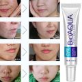 BIOAQUA Pure Skin Acne Removal Anti-Wrinkle Treatment Cream BQY0719. 