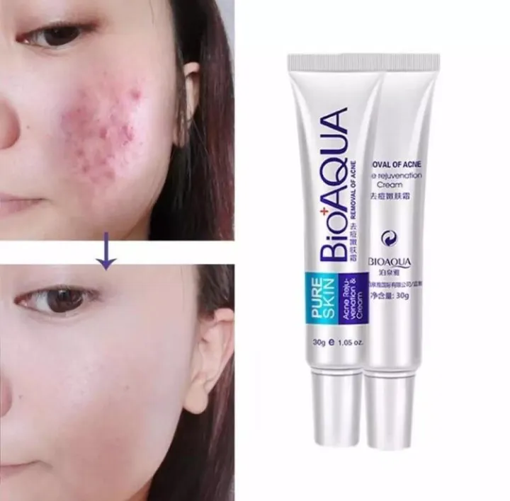 Bioaqua%20-%20Bio%20Aqua%20Acne%20Scar%20Mark%20Removal%20Treatment%20Cream%2030g%20-%20Image%203