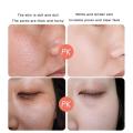Anti Stains Acne Treatment Cream Scar Blackhead Face Cream Shrink Pores Whitening Skin Care Face Cream Korean Cosmetics. 