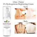 2% Hydroquinone Dark Spot Corrector Remover Face Melasma Cream Treatment Fade T3Z5. 