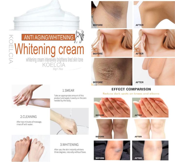 KOELCIA%20Whitening%20Cream%20for%20Sensitive%20Areas,%20Anti-Aging%20&%20Skin%20Tone%20Evenness,%20-%20Image%202