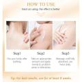 Trimoskin Clobevate Orange Cream (◕‿◕) for Face, Scar Removal, Acne, Hand, Foot, and Pigmentation With Kojic Acid Non Steroidal For All Skin Types - Girl & Women. 