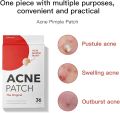 Acne Patch, 36 Patches, Fast-Acting Acne Treatment, Invisible Acne Patch, Overnight Pimple Solution, Blemish Control, Clear Skin Solution, Spot Treatment, Skin-Friendly Acne Care.. 
