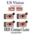 Lens for Damage Eye Extended Wear Iris Light+Free Kit. 