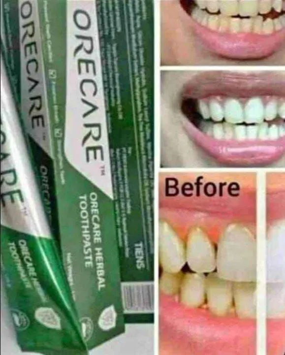 TIENS%20Orecare%20CHINESE%20herbal%20Toothpaste%20135gm%20Toothpaste%20+%201%20toothbrush%20-%20Image%204