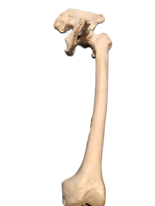 Human%20Lower%20Limb%20Loose%20Bones%20Set%20%7C%20Adult%20%7C%20Large%20Size%20%7C%20PVC%20-%20Image%203